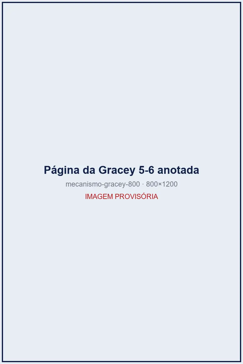 Página da cureta de Gracey 5-6 com pontos de reconhecimento, comparação com a 7-8 e teste rápido